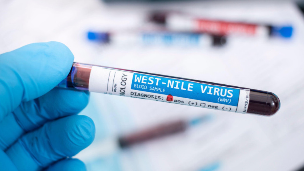 Restricții la donarea de sânge în România din cauza West Nile